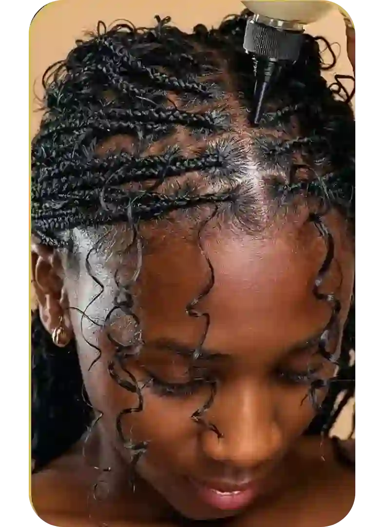 Scalp oil treatment